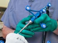 Robot revolutionizes knee replacement surgery