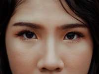 Rhinoplasty