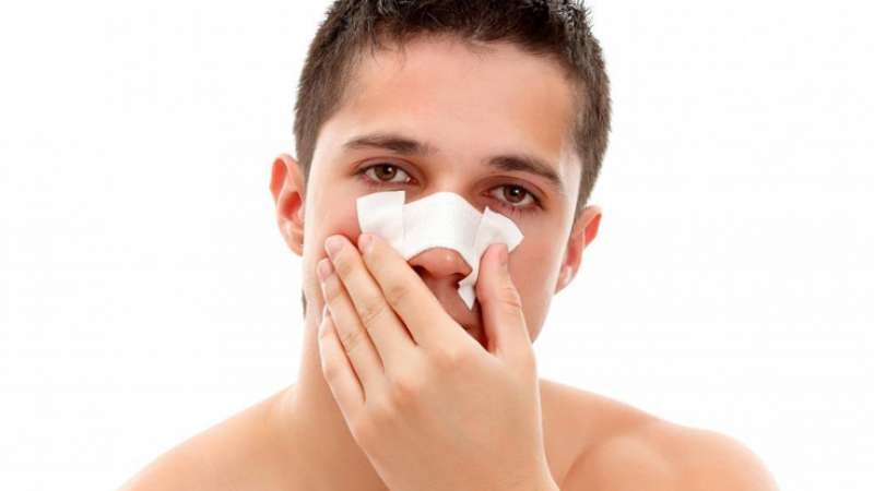 New study: How long does edema after rhinoplasty really last?